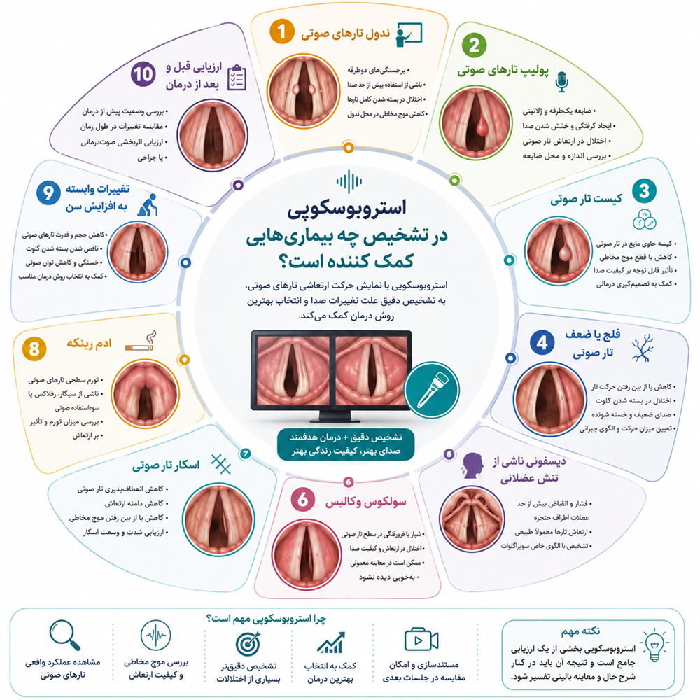 استروبوسکوپی در تشخیص چه بیماری&zwnj;هایی کمک&zwnj;کننده است؟